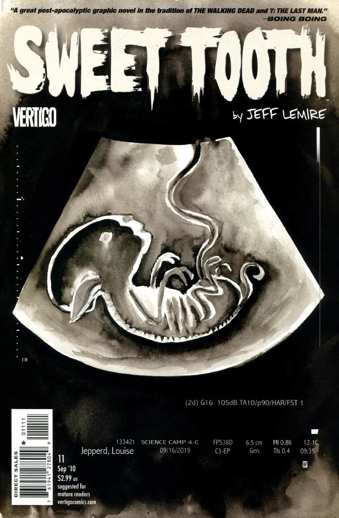 Sweet Tooth #11